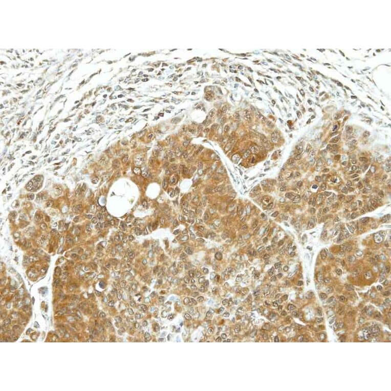 Immunohistochemistry - ARF1 antibody from Signalway Antibody (22691) - Antibodies.com