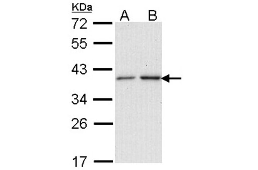 NAT2 antibody from Signalway Antibody (22751) - Antibodies.com