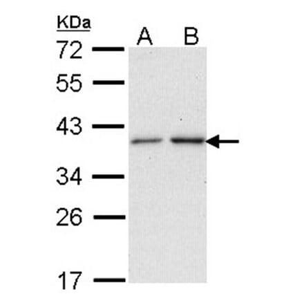 NAT2 antibody from Signalway Antibody (22751) - Antibodies.com
