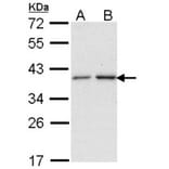 NAT2 antibody from Signalway Antibody (22751) - Antibodies.com