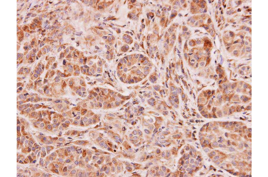 Immunohistochemistry - NAT2 antibody from Signalway Antibody (22751) - Antibodies.com