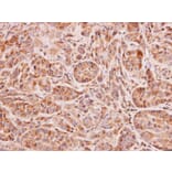 Immunohistochemistry - NAT2 antibody from Signalway Antibody (22751) - Antibodies.com