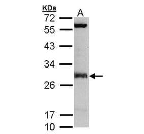 IDI1 antibody from Signalway Antibody (22782) - Antibodies.com