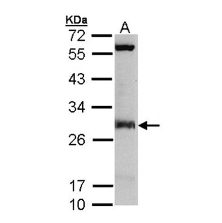 IDI1 antibody from Signalway Antibody (22782) - Antibodies.com