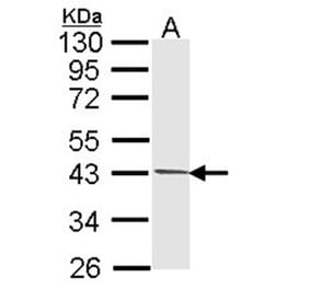 PIM2 antibody from Signalway Antibody (22814) - Antibodies.com
