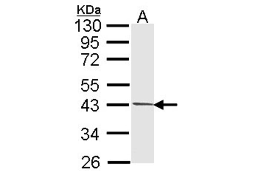PIM2 antibody from Signalway Antibody (22814) - Antibodies.com