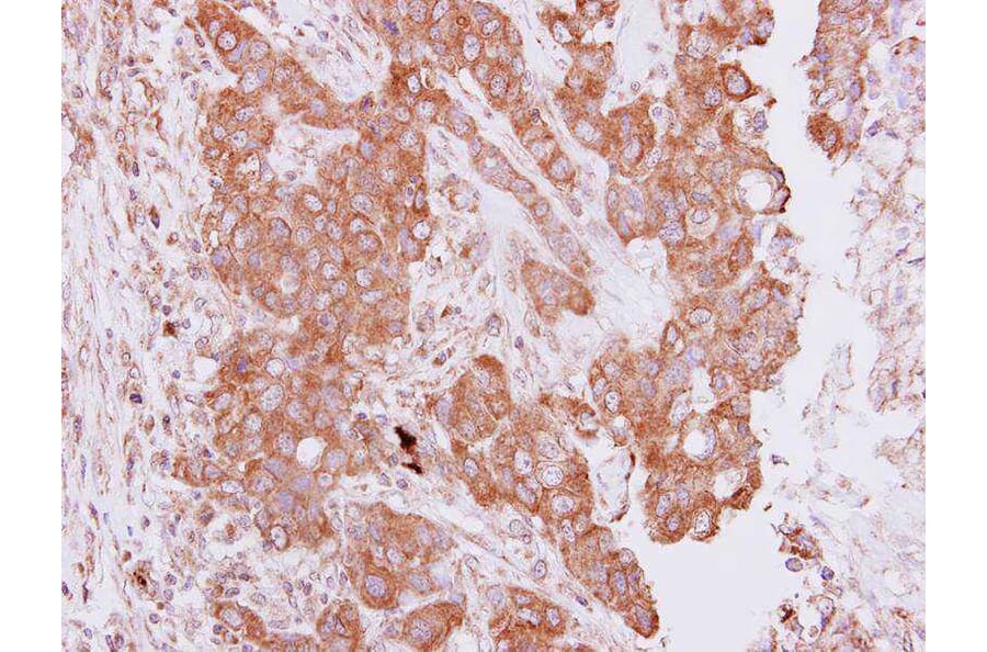 Immunohistochemistry - PIM2 antibody from Signalway Antibody (22814) - Antibodies.com