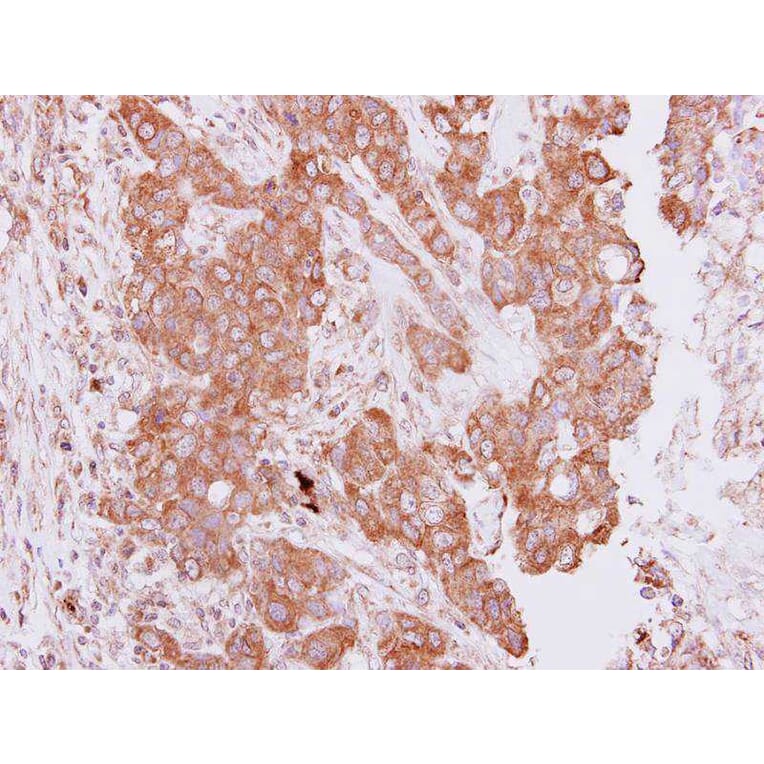 Immunohistochemistry - PIM2 antibody from Signalway Antibody (22814) - Antibodies.com