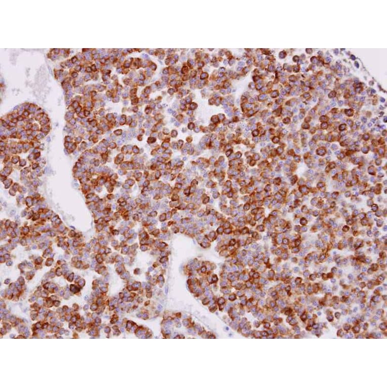 Immunohistochemistry - XPR1 antibody from Signalway Antibody (22817) - Antibodies.com