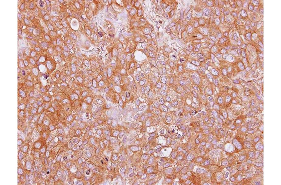 Immunohistochemistry - SAH3 antibody from Signalway Antibody (22835) - Antibodies.com