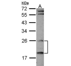RGS4 antibody from Signalway Antibody (22897) - Antibodies.com