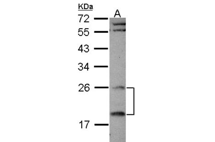 RGS4 antibody from Signalway Antibody (22897) - Antibodies.com