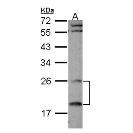 RGS4 antibody from Signalway Antibody (22897) - Antibodies.com