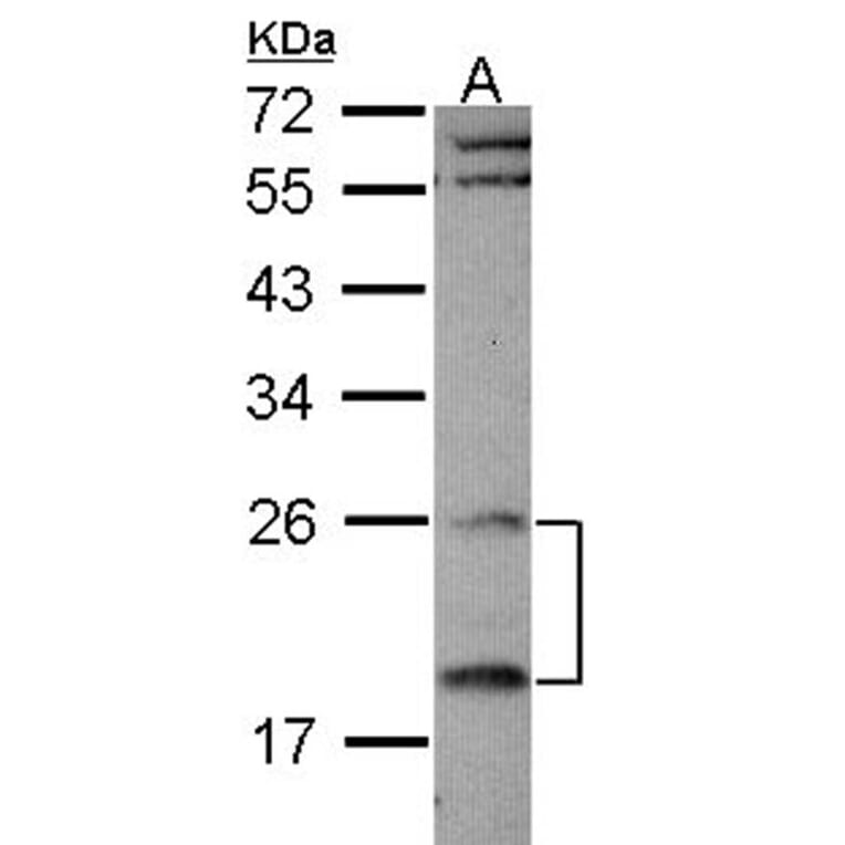 RGS4 antibody from Signalway Antibody (22897) - Antibodies.com