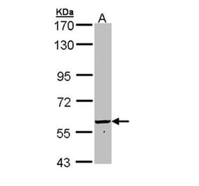 FTCD antibody from Signalway Antibody (22936) - Antibodies.com