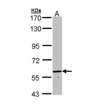 FTCD antibody from Signalway Antibody (22936) - Antibodies.com