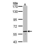 FTCD antibody from Signalway Antibody (22936) - Antibodies.com