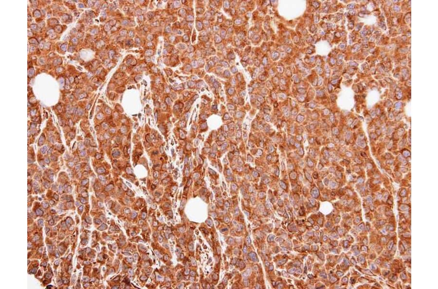 Immunohistochemistry - MUC2 antibody from Signalway Antibody (22938) - Antibodies.com