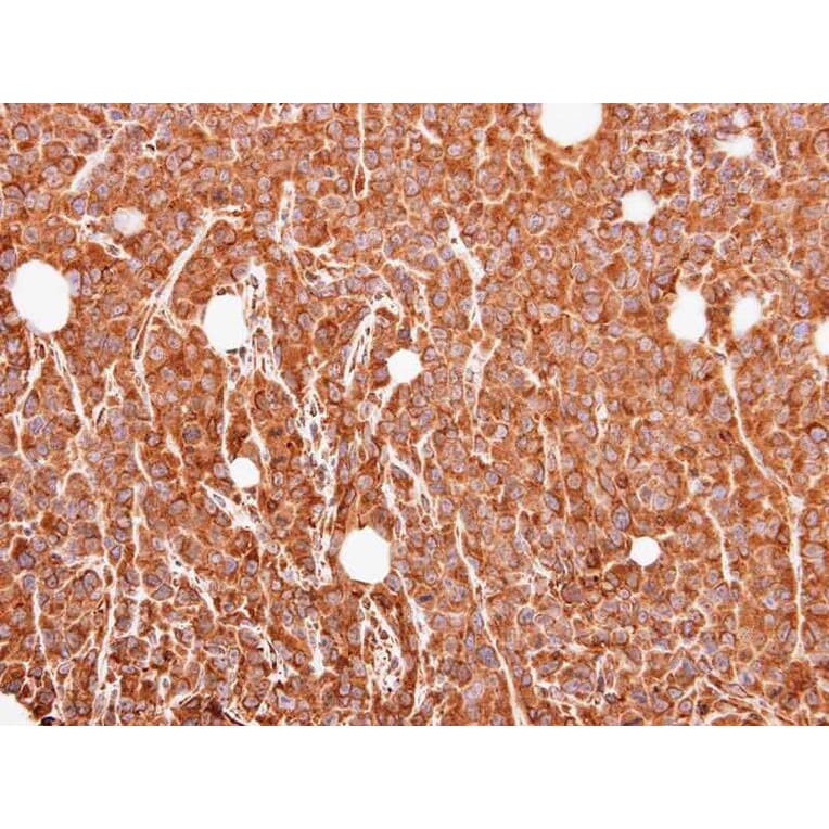 Immunohistochemistry - MUC2 antibody from Signalway Antibody (22938) - Antibodies.com