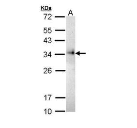 CD74 antibody from Signalway Antibody (22982) - Antibodies.com