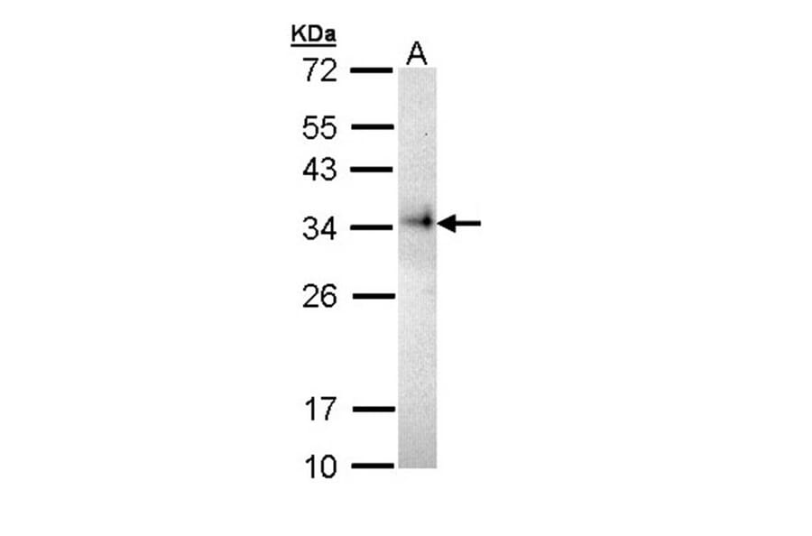 CD74 antibody from Signalway Antibody (22982) - Antibodies.com