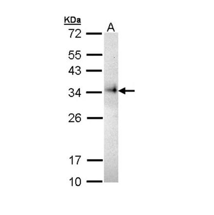 CD74 antibody from Signalway Antibody (22982) - Antibodies.com