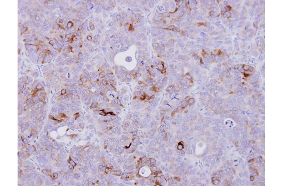 Immunohistochemistry - CD74 antibody from Signalway Antibody (22982) - Antibodies.com