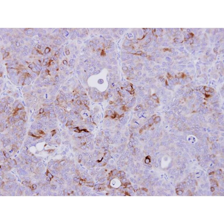 Immunohistochemistry - CD74 antibody from Signalway Antibody (22982) - Antibodies.com