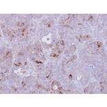 Immunohistochemistry - CD74 antibody from Signalway Antibody (22982) - Antibodies.com