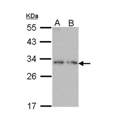 PDYN antibody from Signalway Antibody (23050) - Antibodies.com