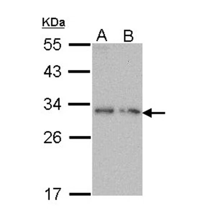PDYN antibody from Signalway Antibody (23050) - Antibodies.com