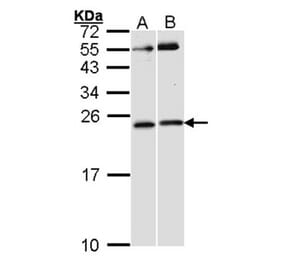RAC1 antibody from Signalway Antibody (23065) - Antibodies.com