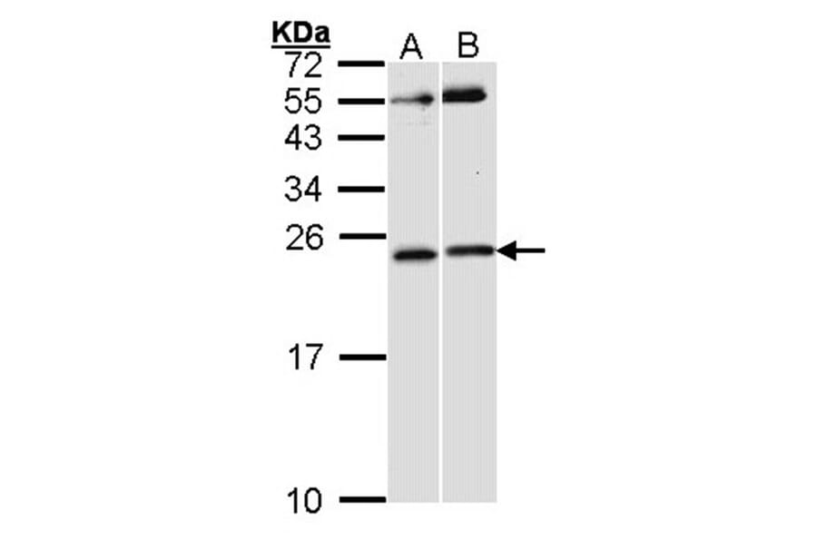 RAC1 antibody from Signalway Antibody (23065) - Antibodies.com