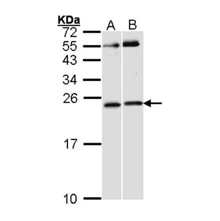 RAC1 antibody from Signalway Antibody (23065) - Antibodies.com