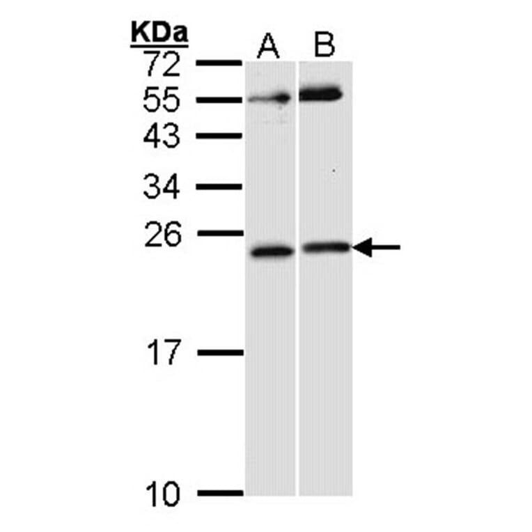 RAC1 antibody from Signalway Antibody (23065) - Antibodies.com