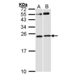 RAC1 antibody from Signalway Antibody (23065) - Antibodies.com