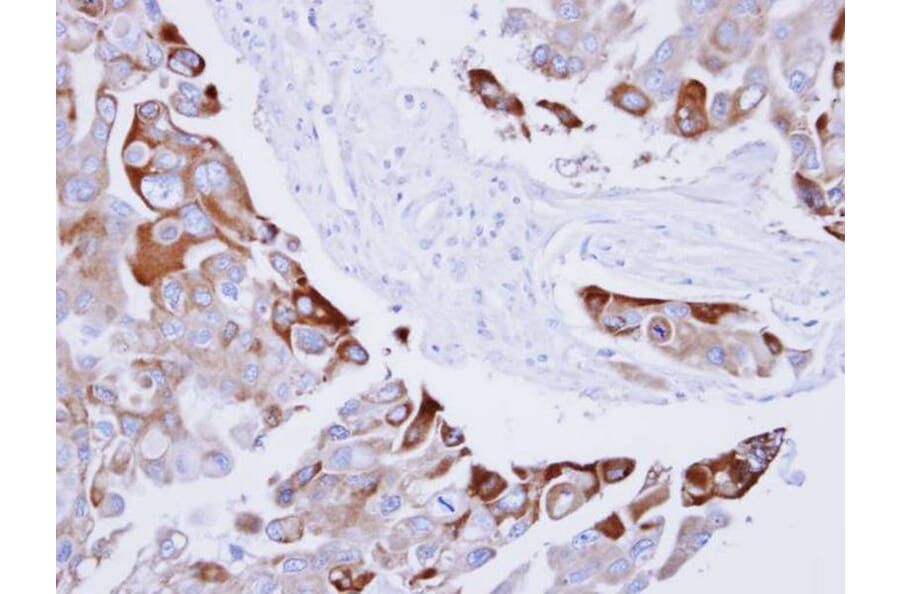 Immunohistochemistry - RAC1 antibody from Signalway Antibody (23065) - Antibodies.com