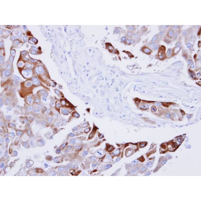 Immunohistochemistry - RAC1 antibody from Signalway Antibody (23065) - Antibodies.com