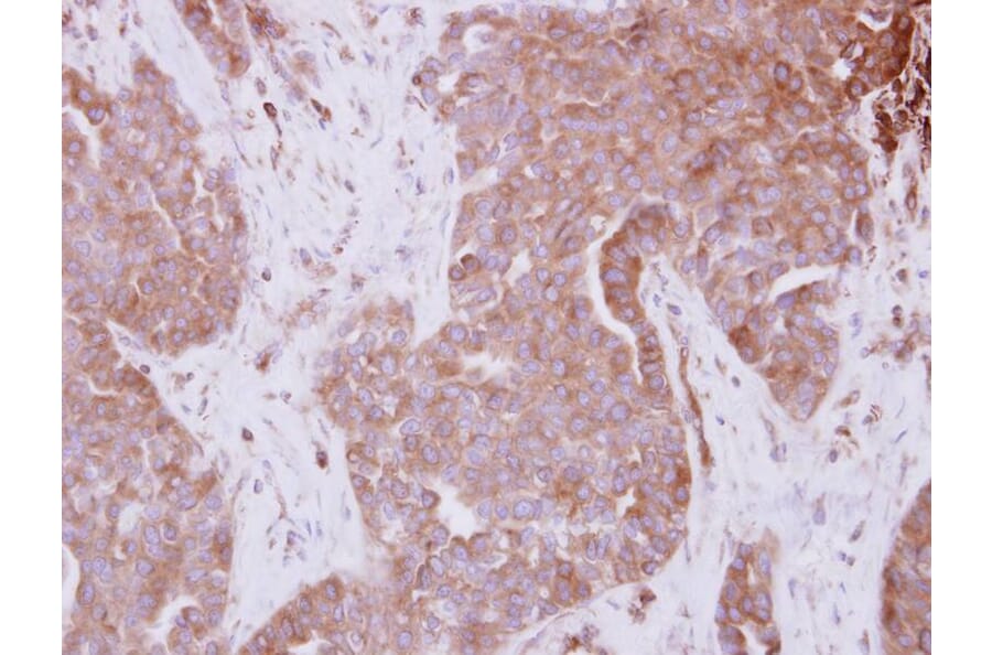 Immunohistochemistry - STAM antibody from Signalway Antibody (23081) - Antibodies.com