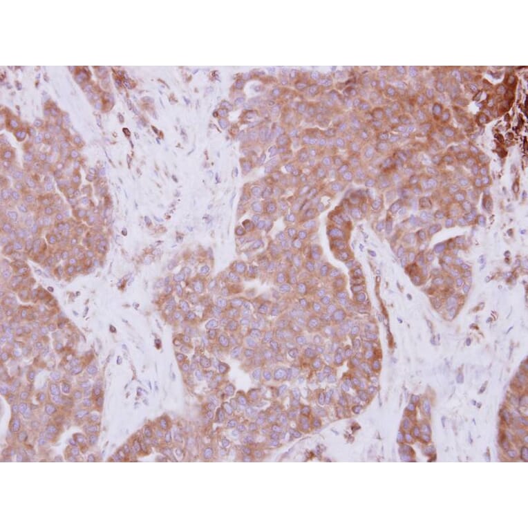 Immunohistochemistry - STAM antibody from Signalway Antibody (23081) - Antibodies.com
