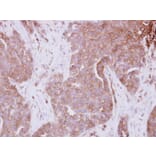 Immunohistochemistry - STAM antibody from Signalway Antibody (23081) - Antibodies.com