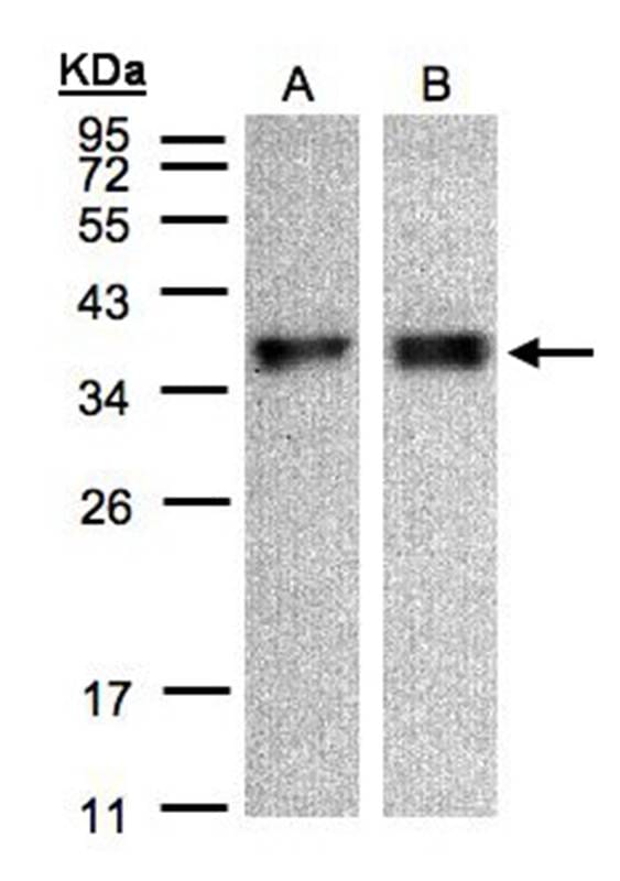 Sample (30 µg of whole cell lysate) A431B: HeLa S312% SDS PAGE Primary antibody diluted at 1: 500
