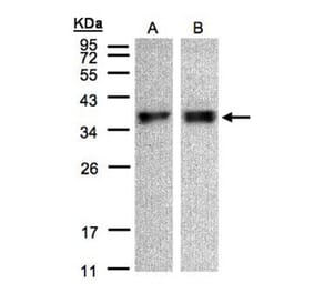 ZPBP antibody from Signalway Antibody (23113) - Antibodies.com