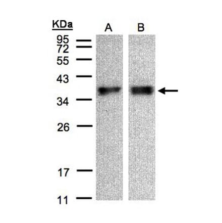 ZPBP antibody from Signalway Antibody (23113) - Antibodies.com