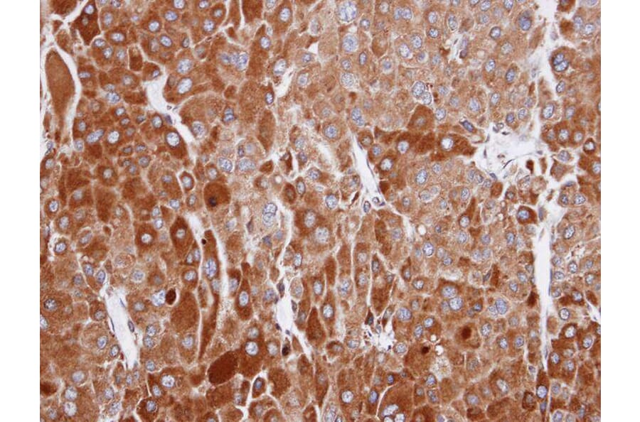 Immunohistochemistry - RIC8 antibody from Signalway Antibody (23149) - Antibodies.com