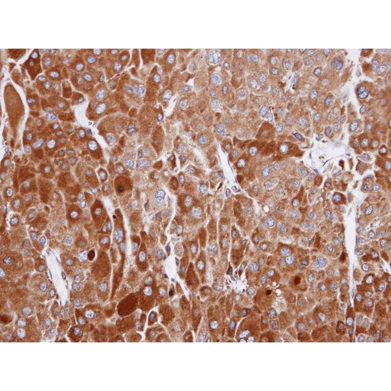 Immunohistochemistry - RIC8 antibody from Signalway Antibody (23149) - Antibodies.com