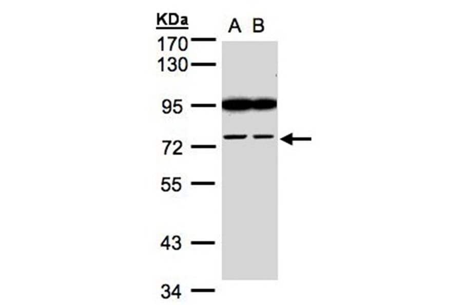 FSD2 antibody from Signalway Antibody (23167) - Antibodies.com
