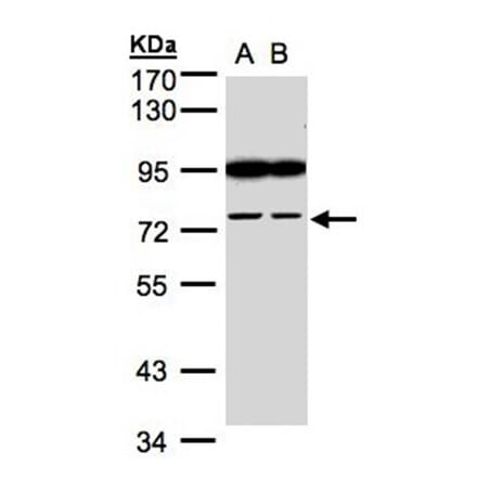 FSD2 antibody from Signalway Antibody (23167) - Antibodies.com