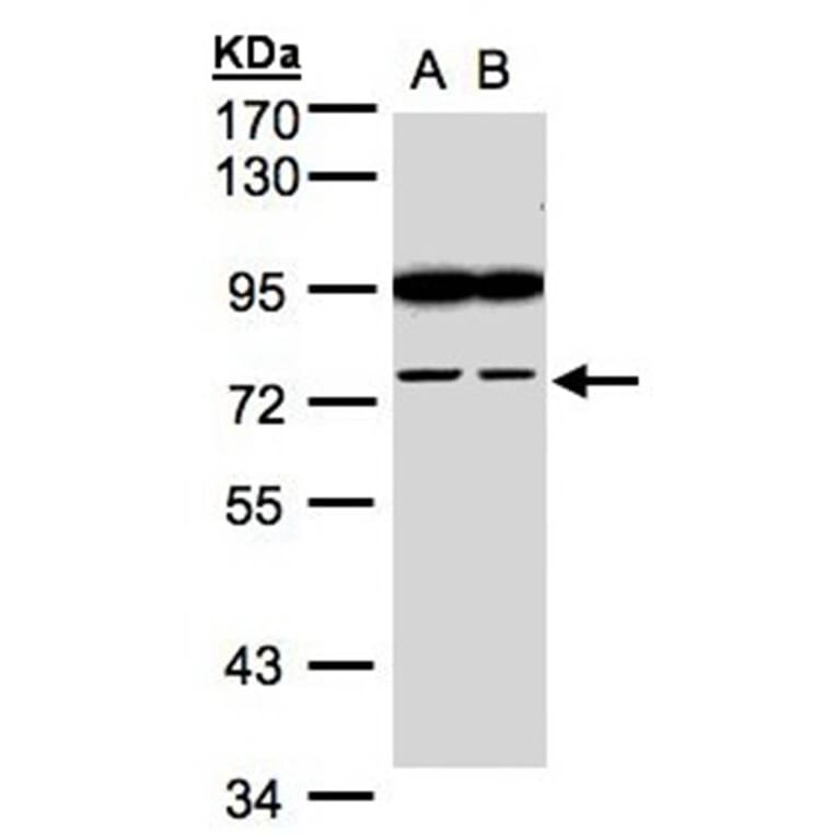 FSD2 antibody from Signalway Antibody (23167) - Antibodies.com