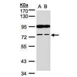 FSD2 antibody from Signalway Antibody (23167) - Antibodies.com